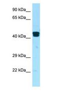 LIMS1 / PINCH Antibody - LIMS1 / PINCH antibody Western Blot of U937.  This image was taken for the unconjugated form of this product. Other forms have not been tested.