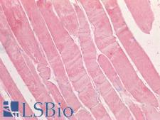 LIMS1 / PINCH Antibody - Human Skeletal Muscle: Formalin-Fixed, Paraffin-Embedded (FFPE)