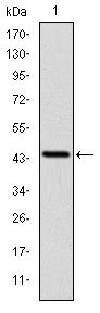 LIMS1 / PINCH Antibody - Western blot using PINCH monoclonal antibody against human PINCH (AA: 87-249) recombinant protein. (Expected MW is 44.2 kDa)