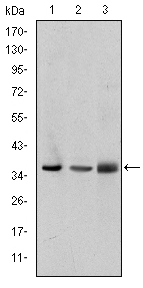 LIMS1 / PINCH Antibody - Western blot using PINCH mouse monoclonal antibody against A549 (1), Jurkat (2), and HeLa (3) cell lysate.