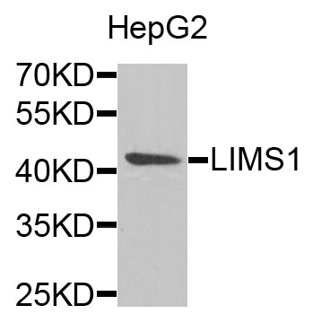 LIMS1 / PINCH Antibody - Western blot analysis of extracts of HepG2 cells.