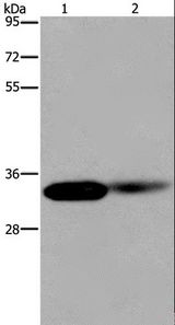 LIMS1 / PINCH Antibody - Western blot analysis of Human kidney and mouse lung tissue, using LIMS1 Polyclonal Antibody at dilution of 1:200.