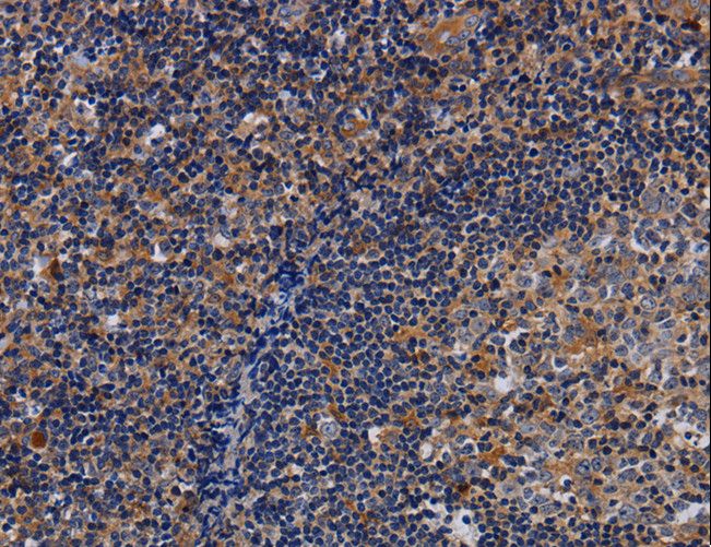 LIMS1 / PINCH Antibody - Immunohistochemistry of paraffin-embedded Human tonsil using LIMS1 Polyclonal Antibody at dilution of 1:40.