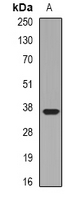 LIMS1 / PINCH Antibody - Western blot analysis of Pinch-1 expression in HepG2 (A) whole cell lysates.
