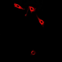 LIMS1 / PINCH Antibody - Immunofluorescent analysis of Pinch-1 staining in A549 cells. Formalin-fixed cells were permeabilized with 0.1% Triton X-100 in TBS for 5-10 minutes and blocked with 3% BSA-PBS for 30 minutes at room temperature. Cells were probed with the primary antibody in 3% BSA-PBS and incubated overnight at 4 deg C in a humidified chamber. Cells were washed with PBST and incubated with a DyLight 594-conjugated secondary antibody (red) in PBS at room temperature in the dark.