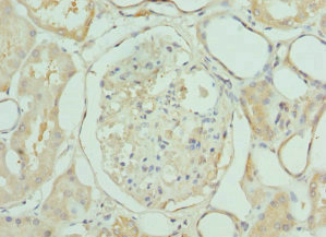 LIMS1 / PINCH Antibody - Immunohistochemistry of paraffin-embedded human kidney tissue at dilution 1:100