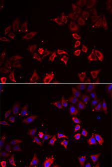LIMS1 / PINCH Antibody - Immunofluorescence analysis of A549 cells using LIMS1 antibody. Blue: DAPI for nuclear staining.
