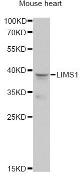 LIMS1 / PINCH Antibody - Western blot analysis of extracts of mouse heart, using LIMS1 antibody at 1:1000 dilution. The secondary antibody used was an HRP Goat Anti-Rabbit IgG (H+L) at 1:10000 dilution. Lysates were loaded 25ug per lane and 3% nonfat dry milk in TBST was used for blocking. An ECL Kit was used for detection and the exposure time was 90s.