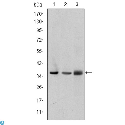 LIMS1 / PINCH Antibody - Western Blot (WB) analysis using Pinch-1 Monoclonal Antibody against A549 (1), Jurkat (2), and HeLa (3) cell lysate.