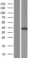 LIMS1 / PINCH Protein - Western validation with an anti-DDK antibody * L: Control HEK293 lysate R: Over-expression lysate
