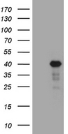 LIMS2 Antibody - HEK293T cells were transfected with the pCMV6-ENTRY control. (Left lane) or pCMV6-ENTRY LIMS2. (Right lane) cDNA for 48 hrs and lysed. Equivalent amounts of cell lysates. (5 ug per lane) were separated by SDS-PAGE and immunoblotted with anti-LIMS2. (1:2000)