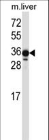 LIMS2 Antibody - LIMS2 Antibody western blot of mouse liver tissue lysates (35 ug/lane). The LIMS2 antibody detected the LIMS2 protein (arrow).