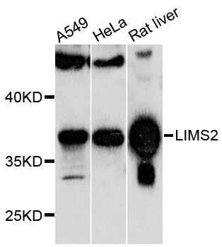 LIMS2 Antibody - Western blot analysis of extracts of various cell lines, using LIMS2 antibody at 1:1000 dilution. The secondary antibody used was an HRP Goat Anti-Rabbit IgG (H+L) at 1:10000 dilution. Lysates were loaded 25ug per lane and 3% nonfat dry milk in TBST was used for blocking. An ECL Kit was used for detection and the exposure time was 60s.