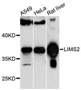 LIMS2 Antibody - Western blot analysis of extracts of various cell lines, using LIMS2 antibody at 1:1000 dilution. The secondary antibody used was an HRP Goat Anti-Rabbit IgG (H+L) at 1:10000 dilution. Lysates were loaded 25ug per lane and 3% nonfat dry milk in TBST was used for blocking. An ECL Kit was used for detection and the exposure time was 60s.