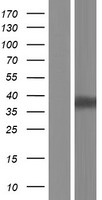 LIMS2 Protein - Western validation with an anti-DDK antibody * L: Control HEK293 lysate R: Over-expression lysate