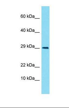 LIMS3 Antibody - Western blot of Human Fetal Kidney. LIMS3 antibody dilution 1.0 ug/ml.  This image was taken for the unconjugated form of this product. Other forms have not been tested.