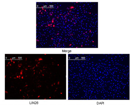LIN28A / LIN28 Antibody - Confocal immunofluorescence of methanol fixed HeLa cells were transfected with pMX construct of human LIN28, cells were analyzed ~62 hours after transfection.
