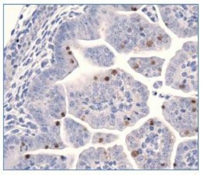 LIN28A / LIN28 Antibody - Immunohistochemistry: Lin28 Antibody - IHC of LIN28 in E17.5 mouse embryo