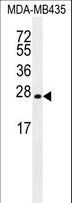 LIN28A / LIN28 Antibody - LIN28 Antibody western blot of MDA-MB435 cell line lysates (35 ug/lane). The LIN28 antibody detected the LIN28 protein (arrow).