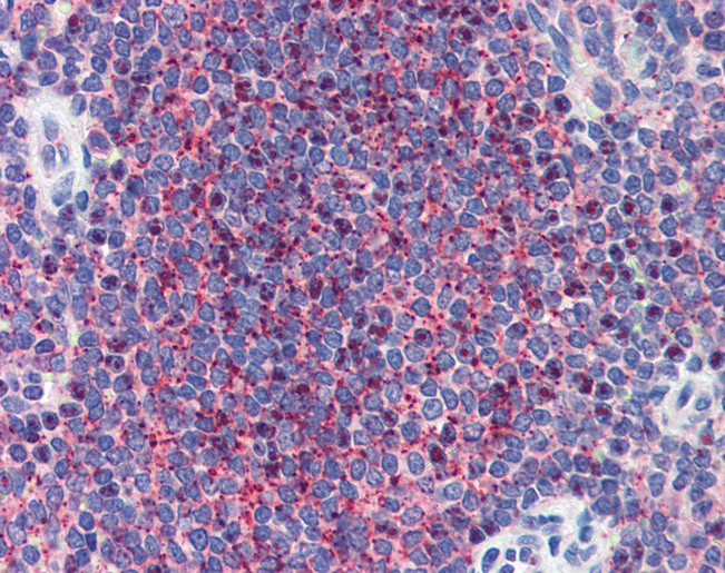 LIN28A / LIN28 Antibody - Anti-LIN28A / LIN28 antibody IHC of human spleen. Immunohistochemistry of formalin-fixed, paraffin-embedded tissue after heat-induced antigen retrieval. Antibody concentration 5 ug/ml.  This image was taken for the unconjugated form of this product. Other forms have not been tested.