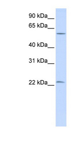 LIN28A / LIN28 Antibody - LIN28A / LIN28 antibody Western blot of HeLa lysate. This image was taken for the unconjugated form of this product. Other forms have not been tested.