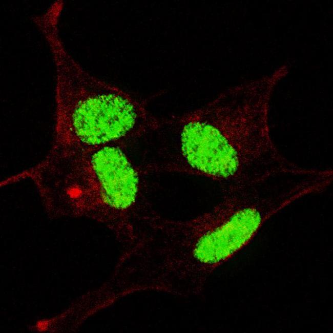 LIN28A / LIN28 Antibody - Fluorescent confocal image of SY5Y cells stained with phospho- LIN28- S134 antibody. SY5Y cells were fixed with 4% PFA (20 min), permeabilized with Triton X-100 (0.2%, 30 min). Cells were then incubated phospho- LIN28- S134 primary antibody (1:100, 2 h at room temperature). For secondary antibody, Alexa Fluor 488 conjugated donkey anti-rabbit antibody (green) was used (1:1000, 1h). Nuclei were counterstained with Hoechst 33342 (blue) (10 ug/ml, 5 min). Note the highly specific localization of the phospho- LIN28 immunosignal mainly to the nucleus, supported by Human Protein Atlas Data (http://www.proteinatlas.org/ENSG00000131914).