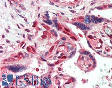 LIN28B Antibody - Human Placenta: Formalin-Fixed, Paraffin-Embedded (FFPE)