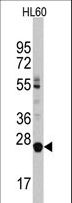 LIN28B Antibody - Western blot of LIN28B Antibody in HL60 cell line lysates (35 ug/lane). LIN28B (arrow) was detected using the purified antibody.