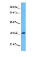 LIN28B Antibody - Western blot of LN28B Antibody with human 786-0 Whole Cell lysate.  This image was taken for the unconjugated form of this product. Other forms have not been tested.