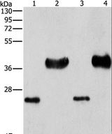 LIN28B Antibody - Western blot analysis of Mouse liver tissue and k562 cell, HeLa and 293T cell, using LIN28B Polyclonal Antibody at dilution of 1:550.