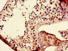 LIN28B Antibody - Immunohistochemistry of paraffin-embedded human testis tissue using LIN28B Antibody at dilution of 1:100
