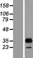LIN28B Protein - Western validation with an anti-DDK antibody * L: Control HEK293 lysate R: Over-expression lysate
