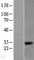 LIN37 Protein - Western validation with an anti-DDK antibody * L: Control HEK293 lysate R: Over-expression lysate