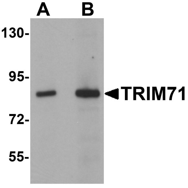 LIN41 / TRIM71 Antibody - Western blot analysis of TRIM71 in human brain tissue lysate with TRIM71 antibody at (A) 1 and (B) 2 ug/ml.