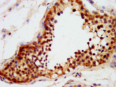 LIN41 / TRIM71 Antibody - Immunohistochemistry image at a dilution of 1:600 and staining in paraffin-embedded human testis tissue performed on a Leica BondTM system. After dewaxing and hydration, antigen retrieval was mediated by high pressure in a citrate buffer (pH 6.0) . Section was blocked with 10% normal goat serum 30min at RT. Then primary antibody (1% BSA) was incubated at 4 °C overnight. The primary is detected by a biotinylated secondary antibody and visualized using an HRP conjugated SP system.