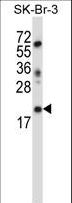 LIN52 Antibody - LIN52 Antibody (N-term ) western blot of SK-BR-3 cell line lysates (35 ug/lane). The LIN52 antibody detected the LIN52 protein (arrow).