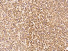 LIN52 Antibody - Immunochemical staining LIN52 in human liver with rabbit polyclonal antibody at 1:200 dilution, formalin-fixed paraffin embedded sections.
