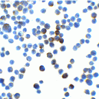 LIN54 Antibody - Immunocytochemistry of LIN54 in HeLa cells with LIN54 at 2.5 µg/mL.