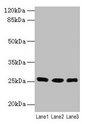 LIN7A Antibody - Western blot All lanes: Lin7a antibody at 6µg/ml Lane 1: Human placenta tissue Lane 2: Mouse kidney tissue Lane 3: Mouse liver tissue Lane 4: Zebrafish lysate Secondary Goat polyclonal to rabbit IgG at 1/10000 dilution Predicted band size: 26 kDa Observed band size: 26, 35, 43, 160 kDa
