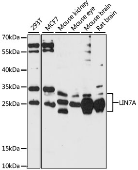 LIN7A Antibody - Western blot analysis of extracts of various cell lines, using LIN7A antibody at 1:1000 dilution. The secondary antibody used was an HRP Goat Anti-Rabbit IgG (H+L) at 1:10000 dilution. Lysates were loaded 25ug per lane and 3% nonfat dry milk in TBST was used for blocking. An ECL Kit was used for detection and the exposure time was 60s.