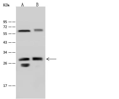 LIN7A Antibody - Anti-LIN7A rabbit polyclonal antibody at 1:500 dilution. Lane A: Mouse brain tissue lysate. Lane B: Rat brain tissue lysate. Lysates/proteins at 30 ug per lane. Secondary: Goat Anti-Rabbit IgG (H+L)/HRP at 1/10000 dilution. Developed using the ECL technique. Performed under reducing conditions. Predicted band size: 26 kDa.