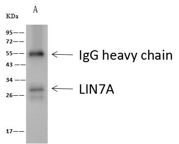 LIN7A Antibody - ATP6V1C1 was immunoprecipitated using: Lane A: 0.5 mg HepG2 Whole Cell Lysate. 4 uL anti-ATP6V1C1 rabbit polyclonal antibody and 60 ug of Immunomagnetic beads Protein A/G. Primary antibody: Anti-ATP6V1C1 rabbit polyclonal antibody, at 1:100 dilution. Secondary antibody: Clean-Blot IP Detection Reagent (HRP) at 1:1000 dilution. Developed using the ECL technique. Performed under reducing conditions. Predicted band size: 44 kDa. Observed band size: 45 kDa.