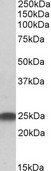 LIN7B Antibody - Goat Anti-LIN7B / MALS-2 Antibody (0.5µg/ml) staining of Rat Brain lysate (35µg protein in RIPA buffer). Primary incubation was 1 hour. Detected by chemiluminescencence.