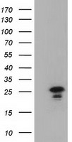 LIN7B Antibody - HEK293T cells were transfected with the pCMV6-ENTRY control (Left lane) or pCMV6-ENTRY LIN7B (Right lane) cDNA for 48 hrs and lysed. Equivalent amounts of cell lysates (5 ug per lane) were separated by SDS-PAGE and immunoblotted with anti-LIN7B.