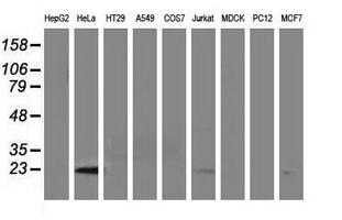 LIN7B Antibody - Western blot of extracts (35 ug) from 9 different cell lines by using anti-LIN7B monoclonal antibody.