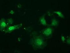 LIN7B Antibody - Anti-LIN7B mouse monoclonal antibody immunofluorescent staining of COS7 cells transiently transfected by pCMV6-ENTRY LIN7B.