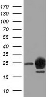 LIN7B Antibody - HEK293T cells were transfected with the pCMV6-ENTRY control (Left lane) or pCMV6-ENTRY LIN7B (Right lane) cDNA for 48 hrs and lysed. Equivalent amounts of cell lysates (5 ug per lane) were separated by SDS-PAGE and immunoblotted with anti-LIN7B.
