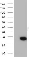 LIN7B Antibody - HEK293T cells were transfected with the pCMV6-ENTRY control (Left lane) or pCMV6-ENTRY LIN7B (Right lane) cDNA for 48 hrs and lysed. Equivalent amounts of cell lysates (5 ug per lane) were separated by SDS-PAGE and immunoblotted with anti-LIN7B.