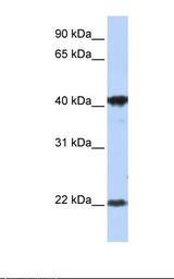 LIN7C / VELI3 Antibody - MCF7 cell lysate. Antibody concentration: 1.0 ug/ml. Gel concentration: 12%.  This image was taken for the unconjugated form of this product. Other forms have not been tested.