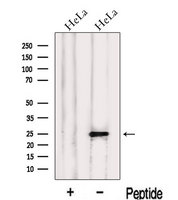 LIN7C / VELI3 Antibody - Western blot analysis of extracts of HeLa cells using LIN7C antibody. The lane on the left was treated with blocking peptide.